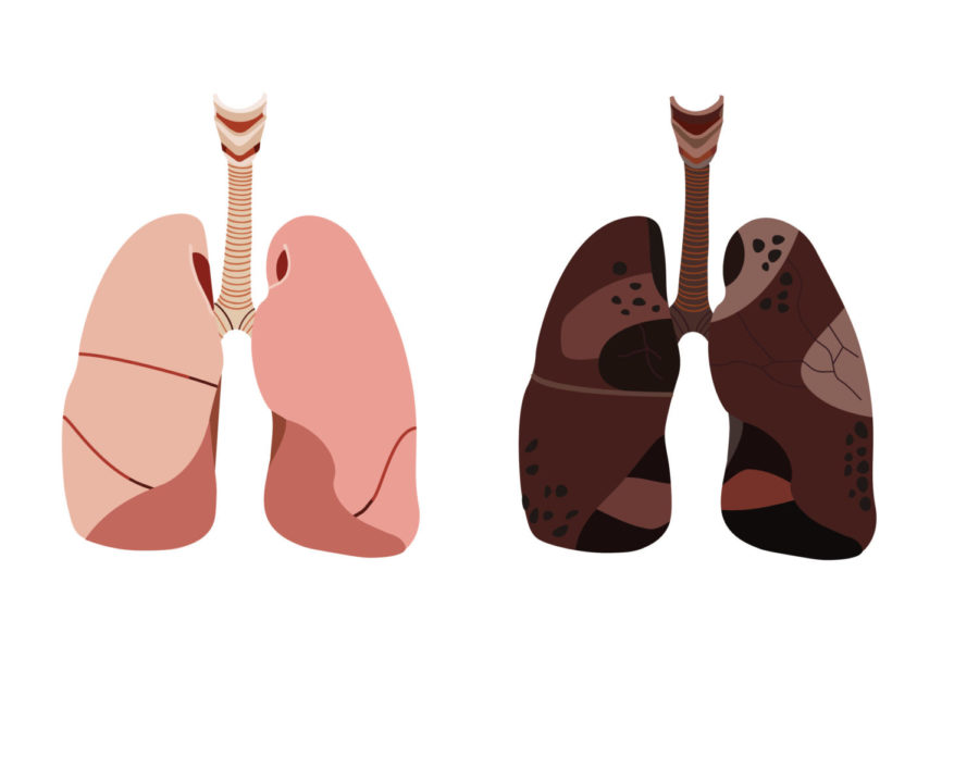 The+lung+shown+on+the+right+reveals+the+harmful+effects+of+vaping.